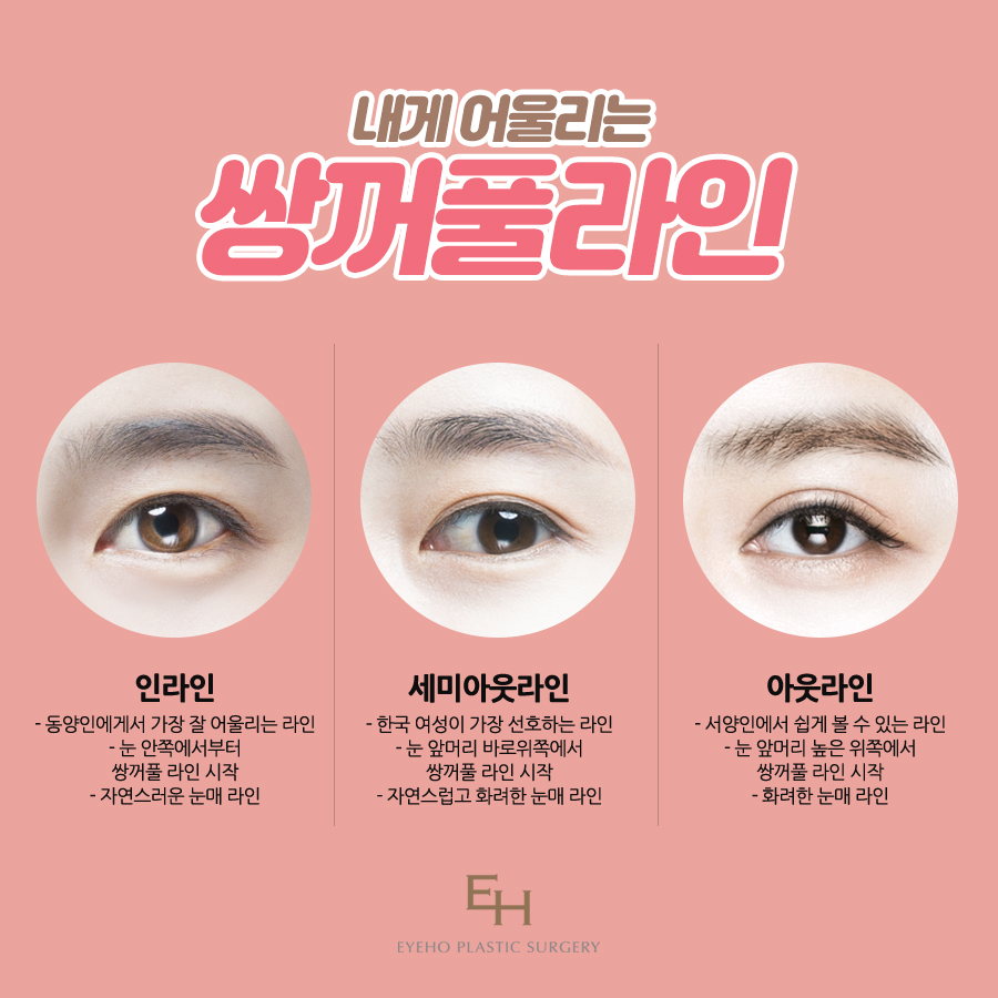 눈성형외과 선택하는 기준 관련 이미지 4