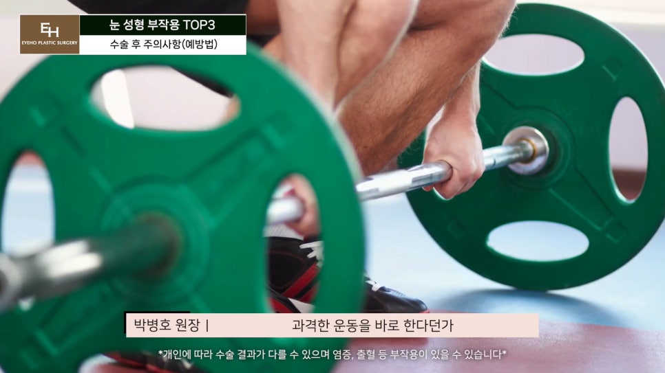 눈재수술 고민이신 분들 주목!! 관련 이미지 58