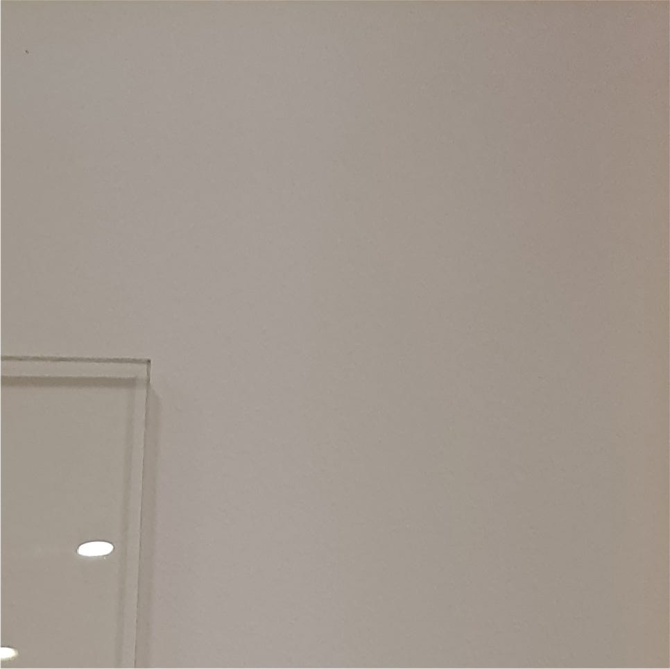 안검하수눈매교정 진행하며 관련 이미지 21