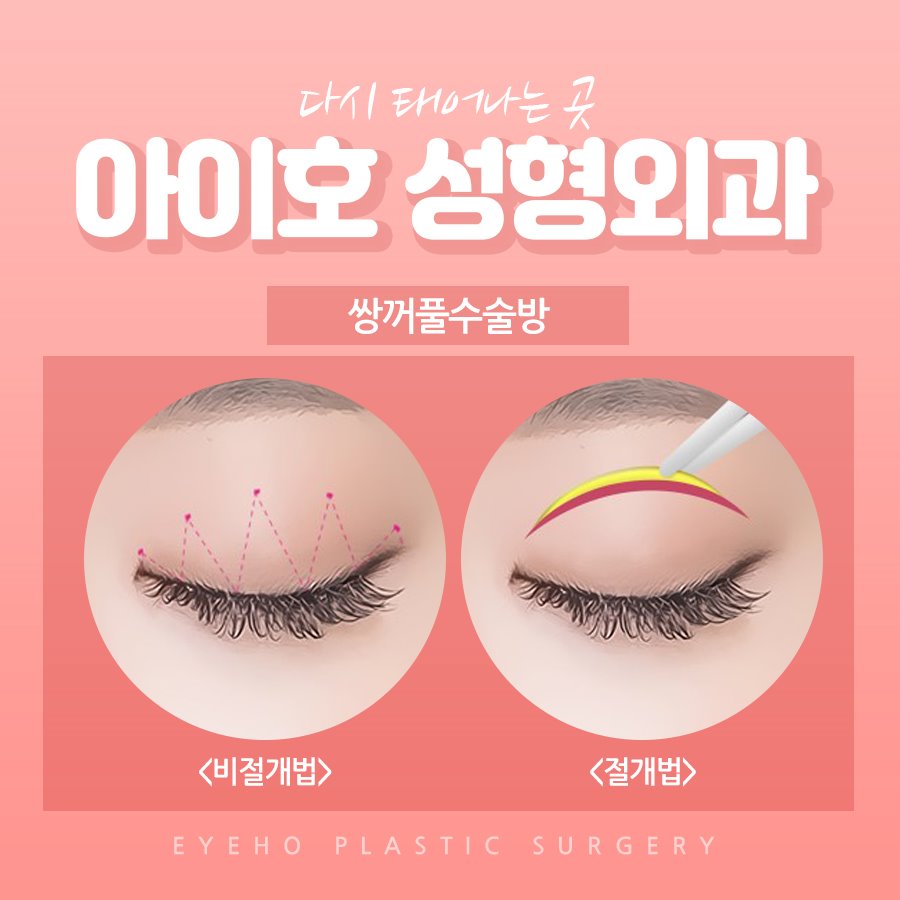 눈성형외과 선택하는 기준 관련 이미지 2