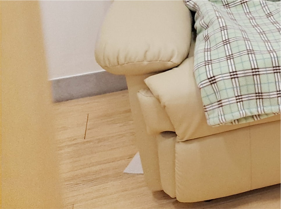 쌍수 매몰법 자연스러운 눈매로 관련 이미지 21