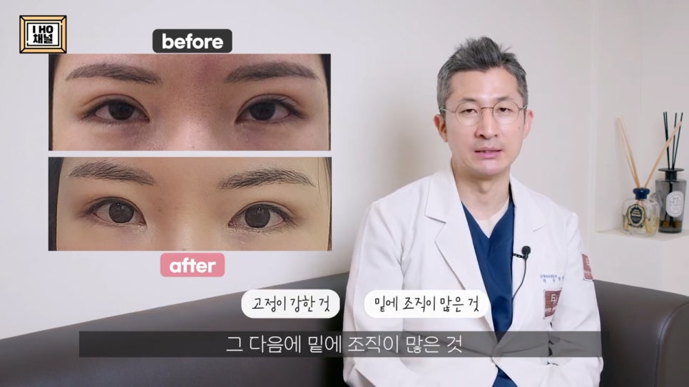 소세지눈 다 같은 게 아니다!? 유형별 재수술 방법에 대해 알려드리겠습니다. 관련 이미지 53