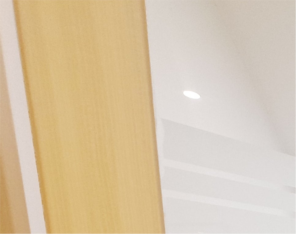 눈매교정 쌍수 : 무쌍 눈매교정 후기, 눈매교정 가격 비교 및 부작용 관련 이미지 16