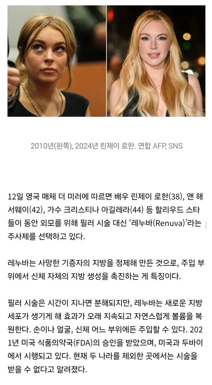 레누바(Renuva)와 줄기세포 지방이식 관련 이미지 2