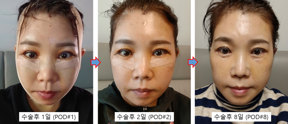 수술만큼 중요한 회복, 결과를 바꾸는 관리의 차이 관련 이미지 4