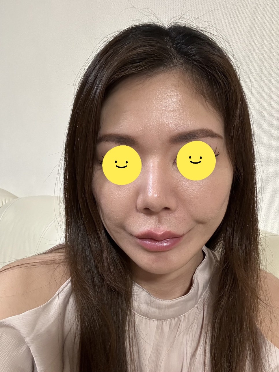노화에 따른 얼굴형의 변화 관련 이미지 6
