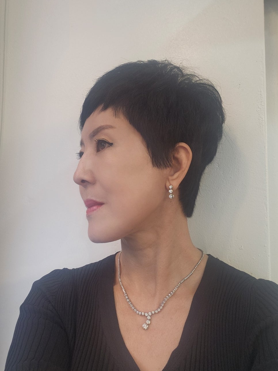자연스러운 안면거상의 최종결과 관련 이미지 4