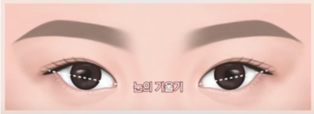 눈 아래부분을 화려하게 만드는 눈성형 관련 이미지 3