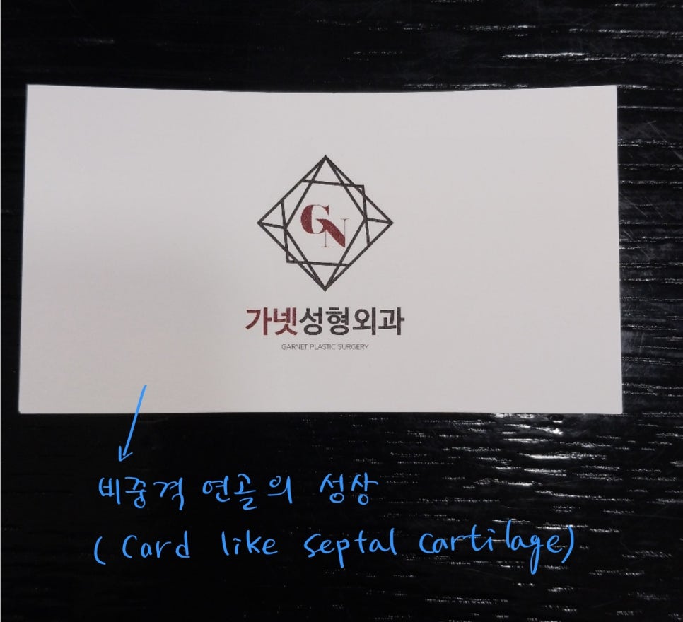 코성형후에 코가 휘었을때의 재수술 관련 이미지 4