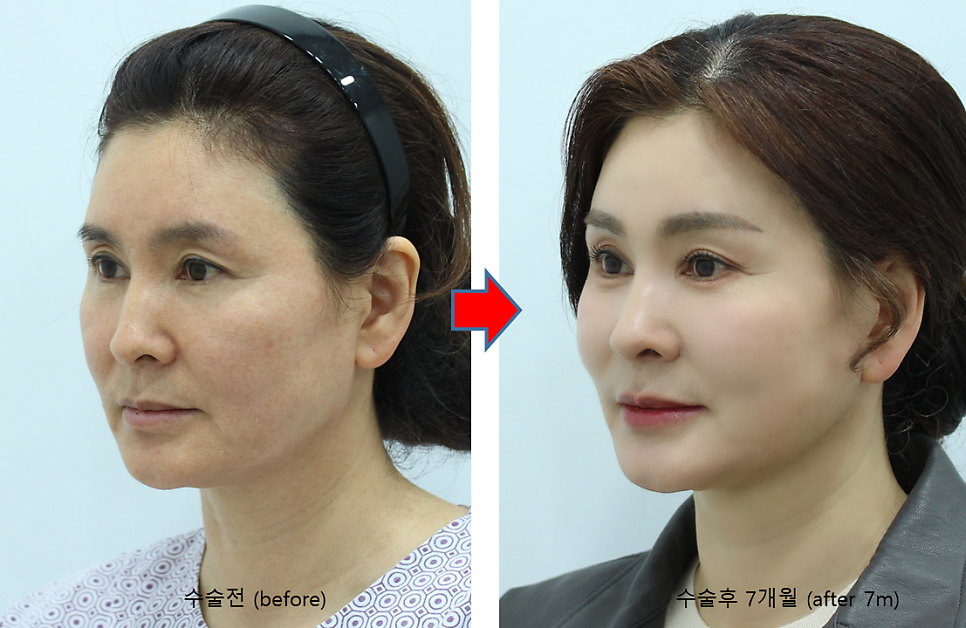결혼식 제2의 주인공을 위한 관련 이미지 7