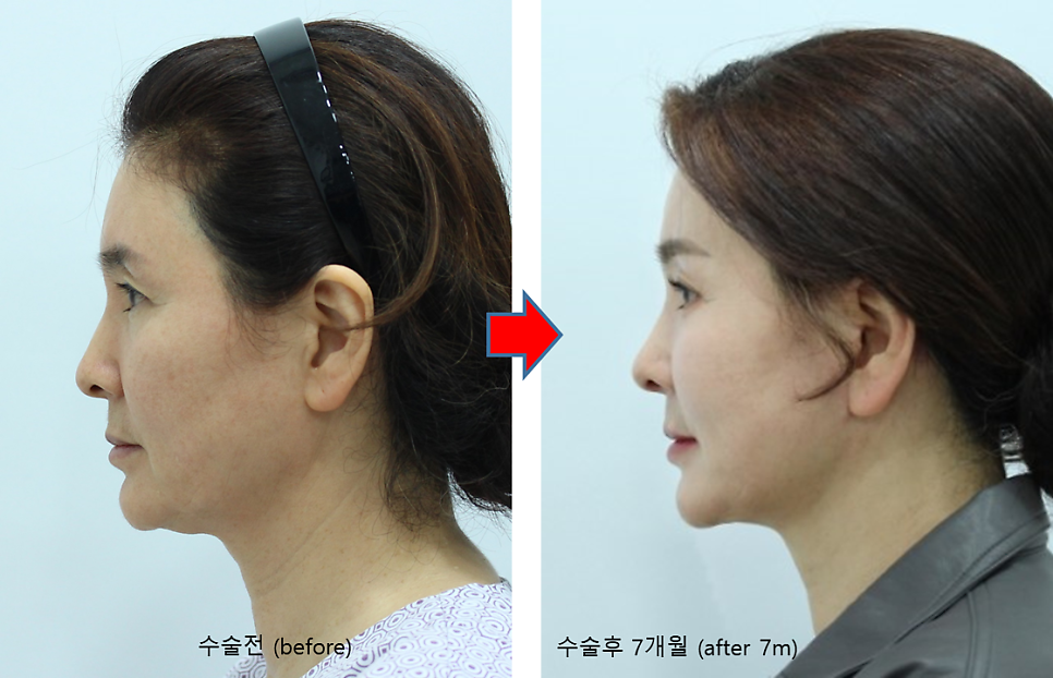 결혼식 제2의 주인공을 위한 관련 이미지 6