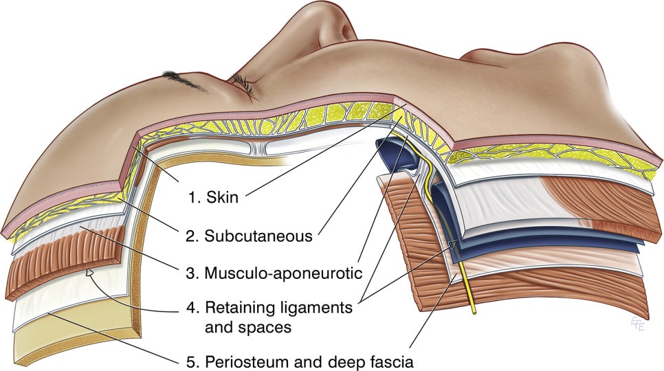 Deep Plane Facelift and Neck Lift image 1