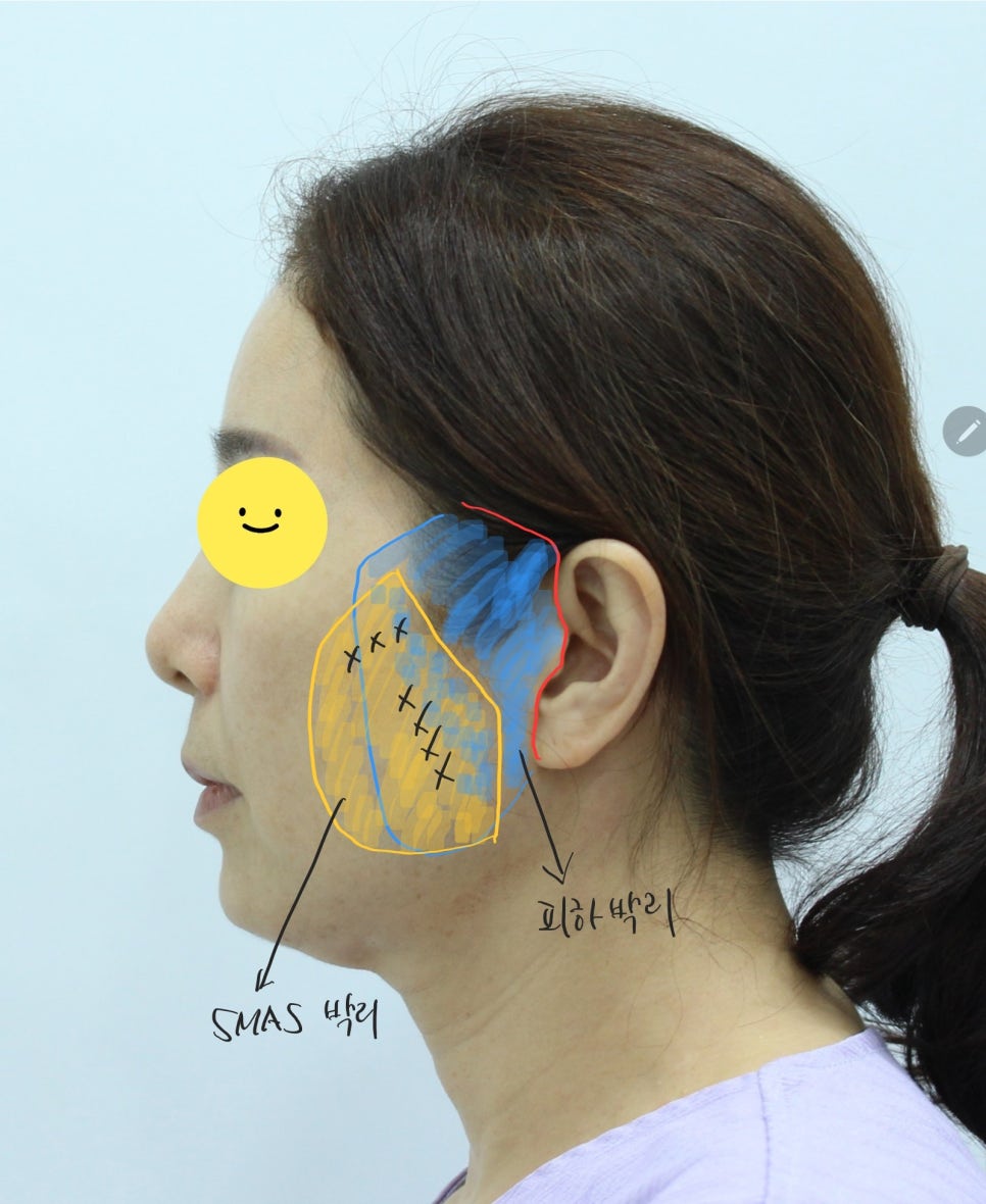 미니거상의 종류 관련 이미지 7