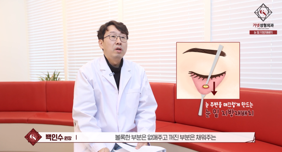 압구정성형외과에서 알아보는 눈밑지방재배치 수술 방법과 성공유형! 관련 이미지 4