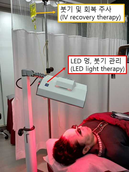 Mother’s Day Top Pick for a Gratitude-Driven Facial Procedure: The Recovery Process After Lower Blepharoplasty A to Z image 3