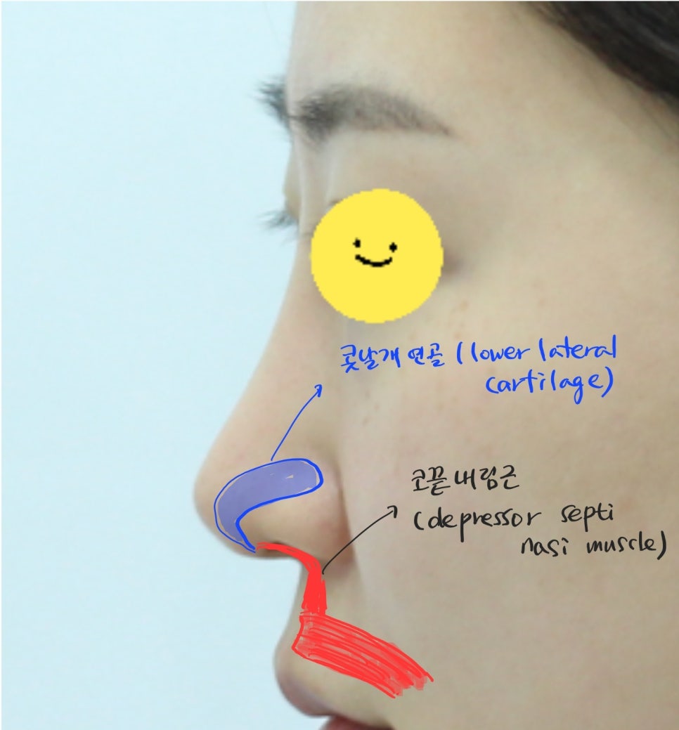 긴코 교정과 비순각 조절을 위한 코끝 리모델링 관련 이미지 3