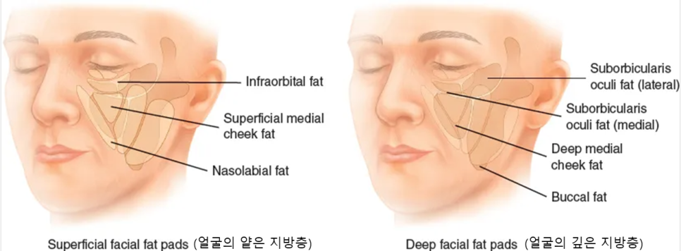 얼굴의 지방층 변화와 중년지방이식 관련 이미지 1