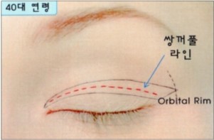 50대 쌍꺼풀 수술, 이마거상과 함께해야 자연스러운 이유 관련 이미지 1