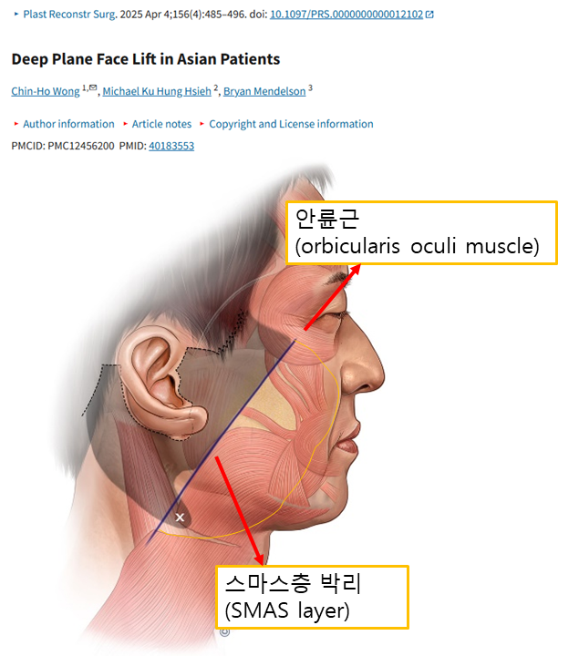 눈밑 수술을 하지 않았는데, 눈밑이 좋아졌습니다 관련 이미지 2