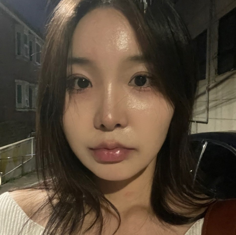 Will Rhinoplasty Cause Inflammation If You Have It in the Summer? Here’s a Real Recovery Case image 6