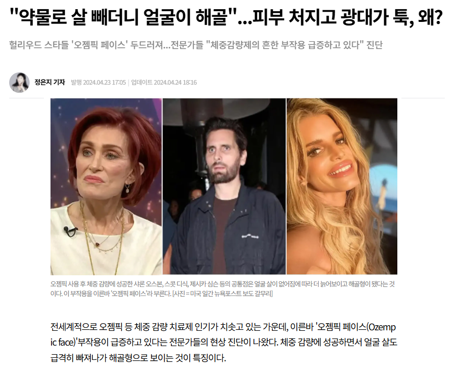 Facial Aging After Successful Weight Loss: Causes and Solutions for Ozempic Face image 2