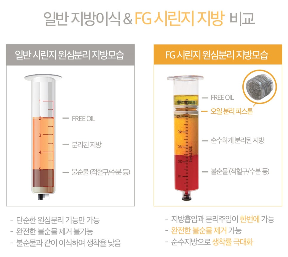 자연스러운 볼륨감을 위한 지방이식 관련 이미지 3