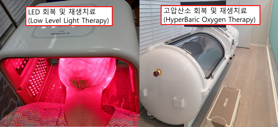 이마거상, 붓기·멍·통증이 걱정된다면? Full HD 내시경이 중요한 이유 관련 이미지 7