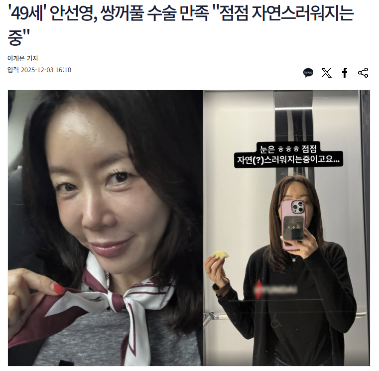 Key Points of Eye Surgery for People in Their 40s and 50s, Seen Through Ahn Seon-young’s Eye Surgery image 1