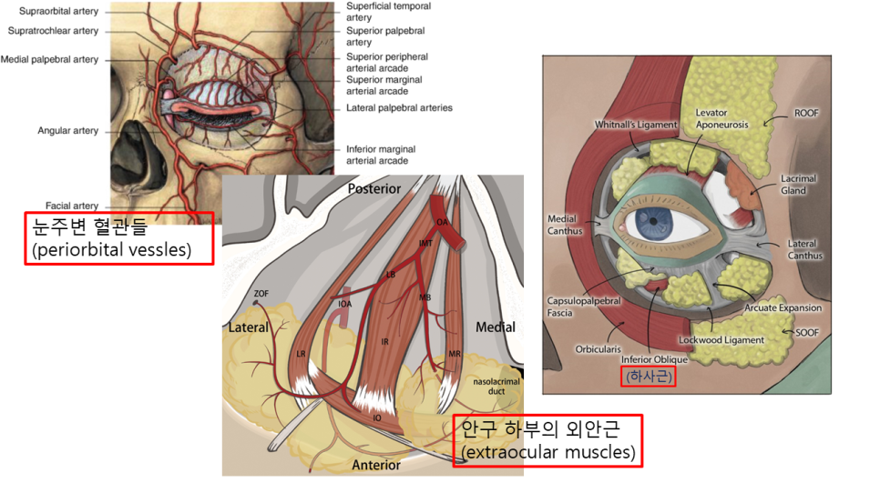 눈밑지방재배치, 복시&middot;사시는 걱정해야 할까요? (드문 부작용과 회복 과정) 관련 이미지 1
