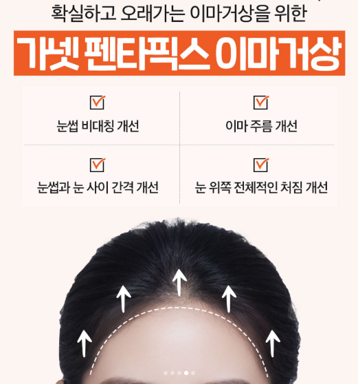 The Effect of Forehead Lift Surgery on the Eyes image 6