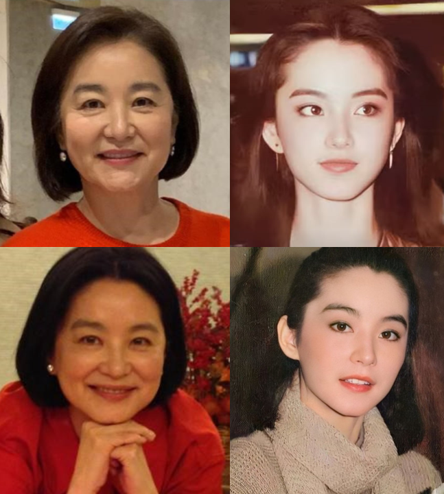 The Aging Process of the Nose and Midlife Rhinoplasty image 4