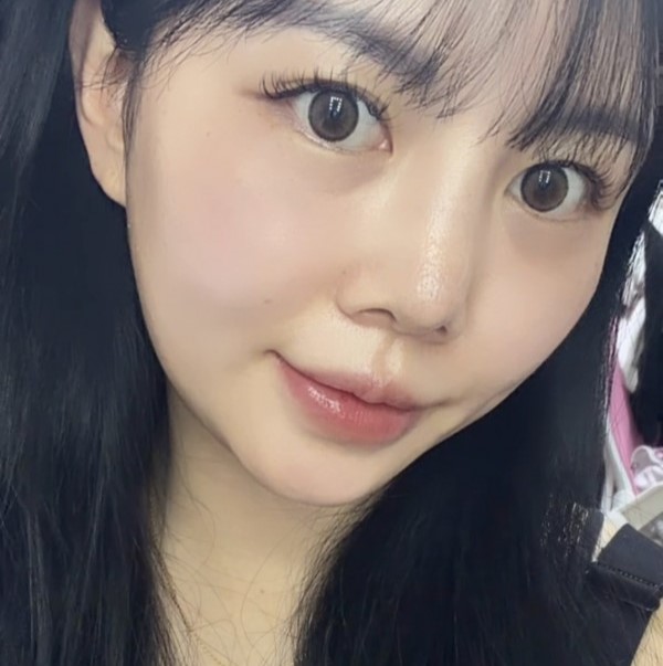 늑연골로 만든 콧대, 정말 흡수될까요? 관련 이미지 8