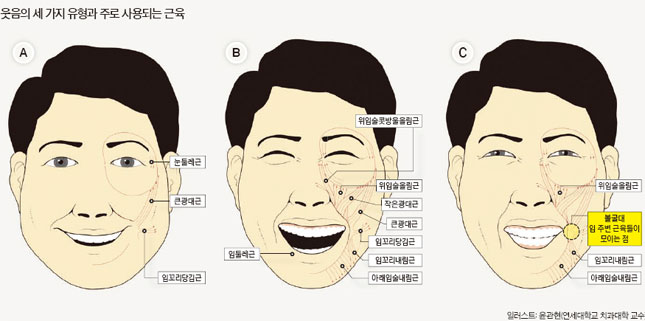중년 남성 하안검 수술과 표정주름 관련 이미지 1