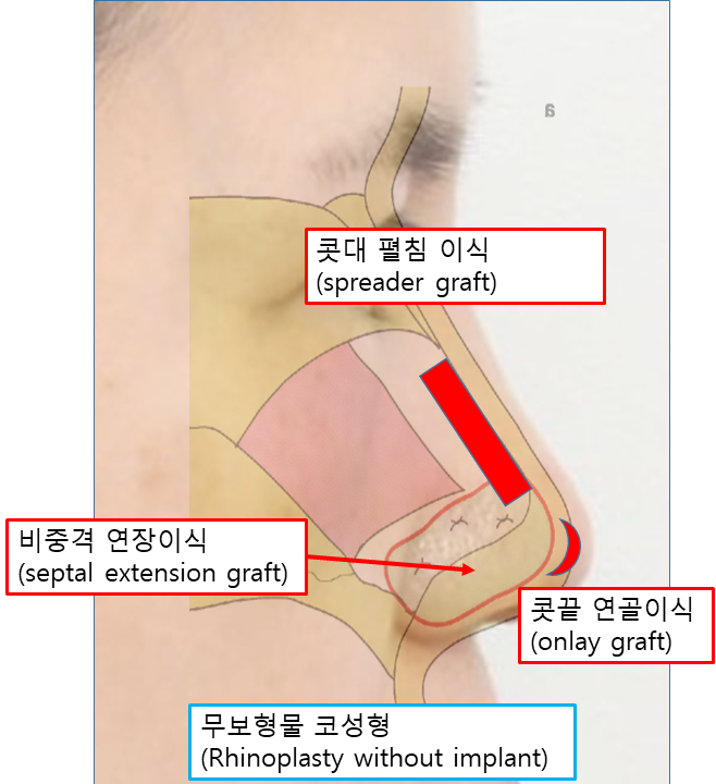 코도 나이가 듭니다: 무보형물 코성형과 안티에이징 관련 이미지 4