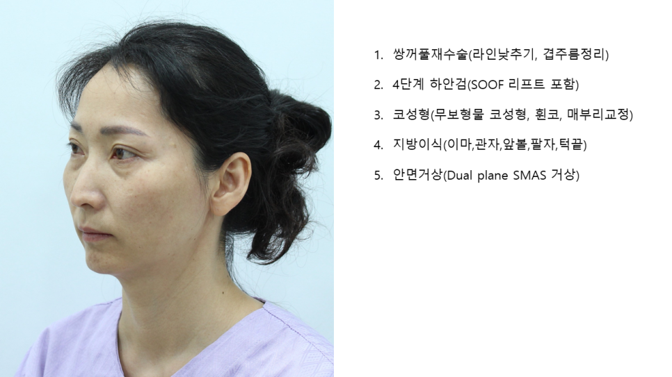 The Surgery Time and Recovery Period for Various Middle-Age Anti-Aging Surgeries image 3