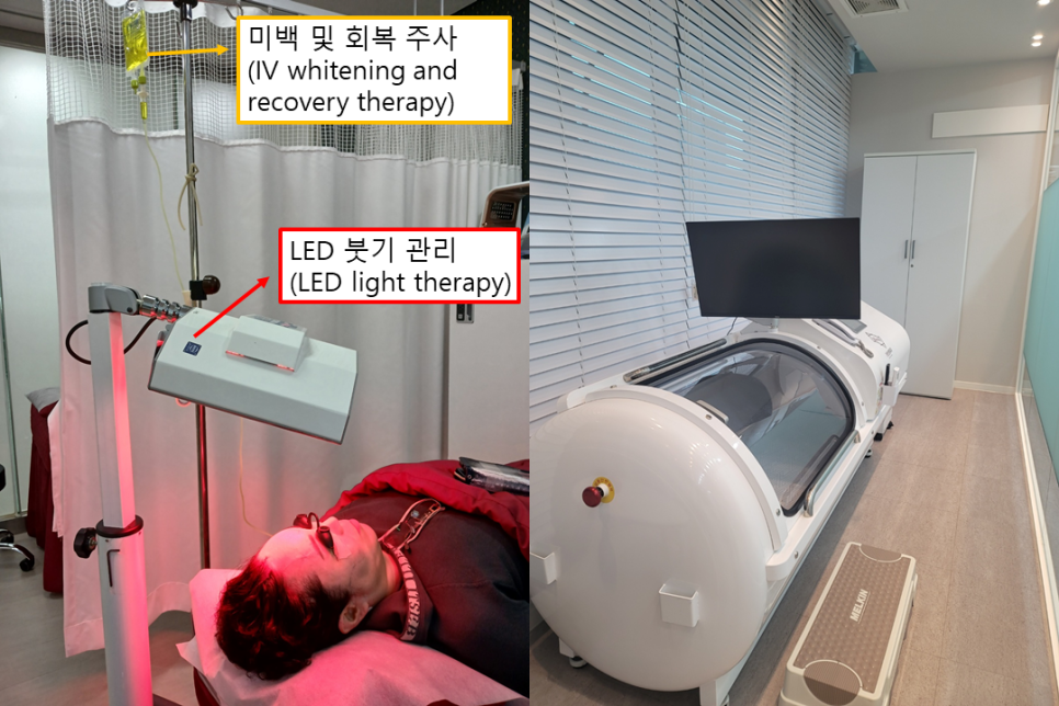 배우 이미숙도 경험한 고압산소치료, 왜 주목받고 있을까요? 관련 이미지 4