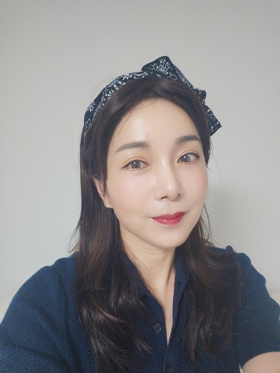 얼굴의 지방층 변화와 중년지방이식 관련 이미지 11