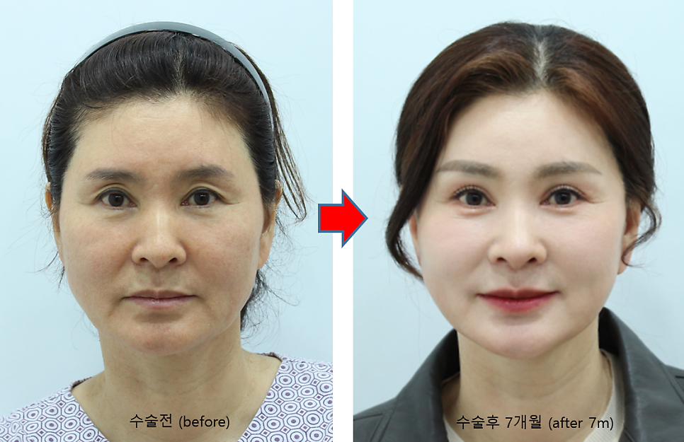 결혼식 제2의 주인공을 위한 관련 이미지 5