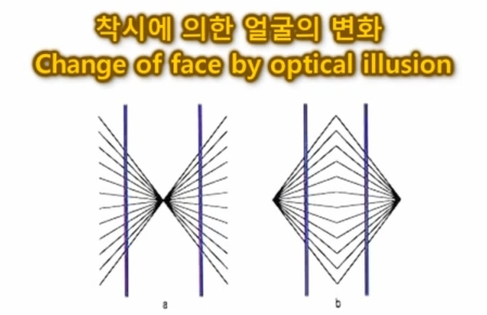Rhinoplasty + Forehead Fat Grafting: Why the Face’s Mood Changes image 4