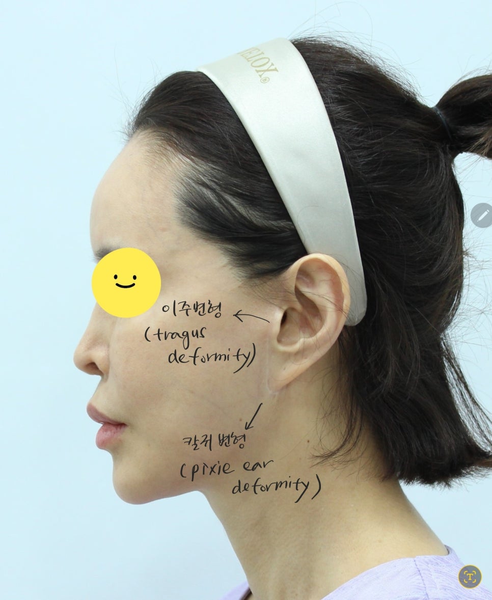 딥 미니거상을 통한 이주의 재건 관련 이미지 2
