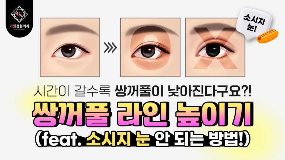 쌍꺼풀라인높이기 쌍수재수술 비결, 가넷성형외과에서 알아보세요! 관련 이미지 1
