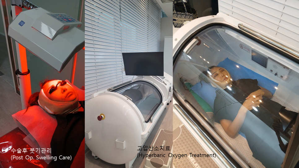 Hyperbaric Oxygen Therapy for Faster Recovery After Plastic Surgery image 3