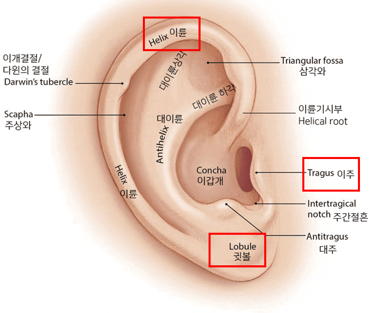 딥미니거상의 절개선과 귀모양의 보존 관련 이미지 1