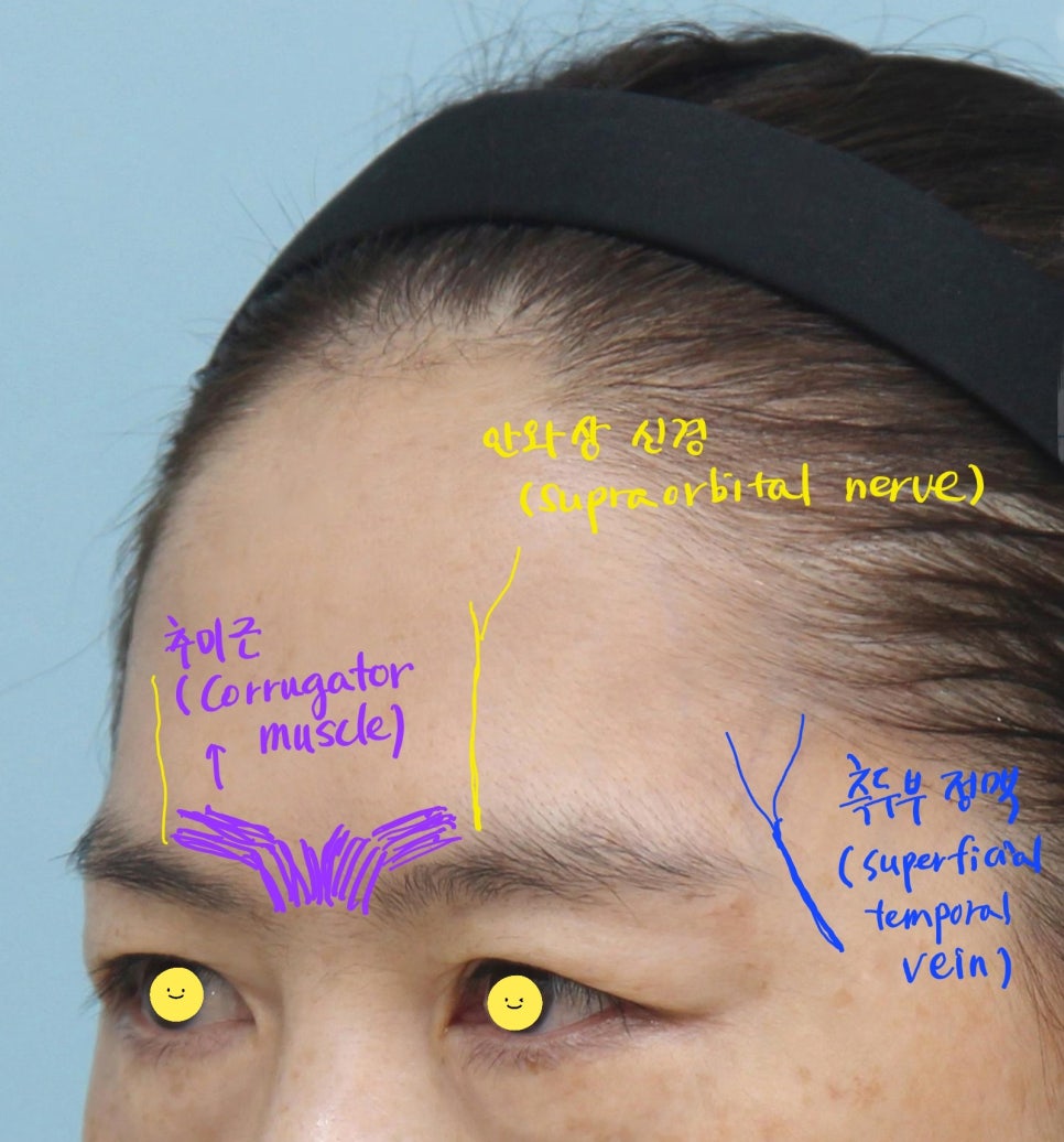 이마거상의 수술 과정 관련 이미지 2