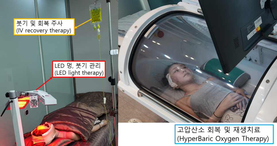 안면윤곽수술 후 피부처짐, 맞춤형 거상수술이 필요한 이유 관련 이미지 6