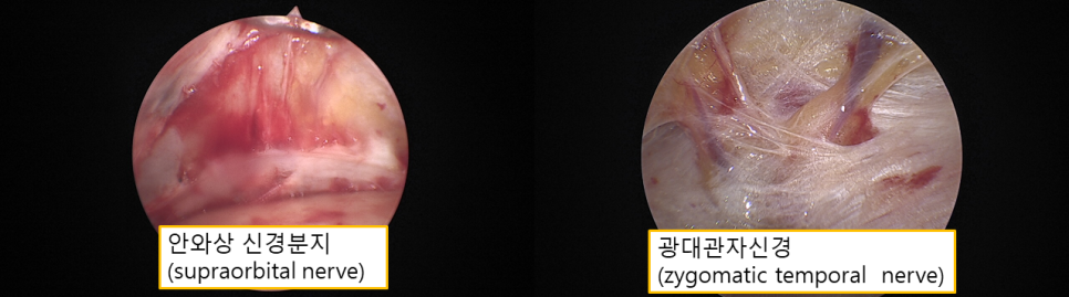 70대도 편하게 받는 내시경 이마거상 관련 이미지 3
