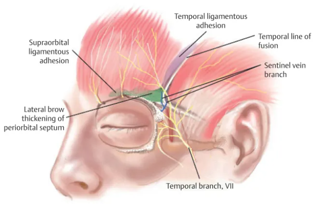 The Effect of Forehead Lift Surgery on the Eyes image 1