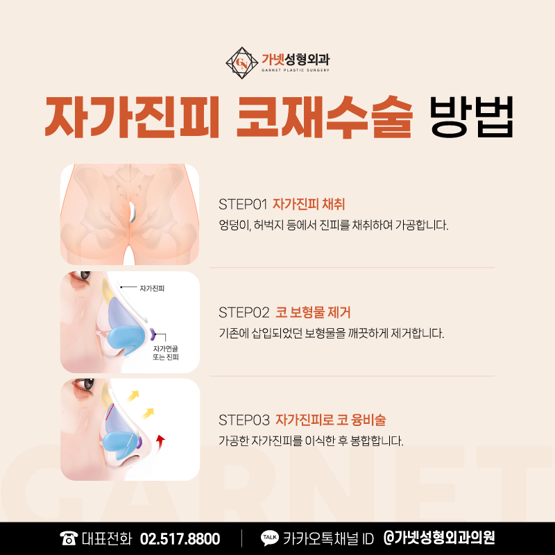 코실리콘제거비용 보다 중요하게 알아 봐야 할 것은? 관련 이미지 6
