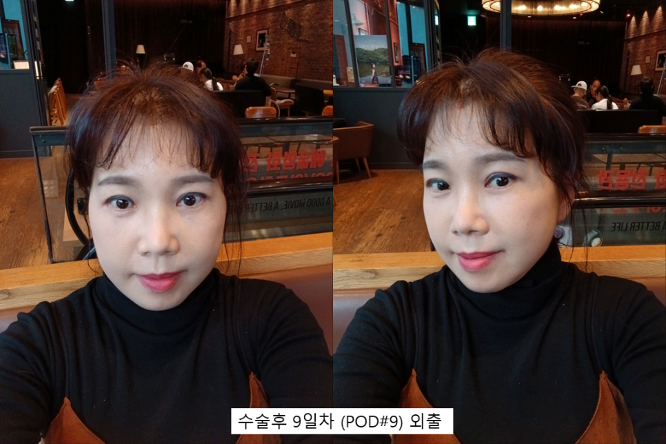 수술만큼 중요한 회복, 결과를 바꾸는 관리의 차이 관련 이미지 6