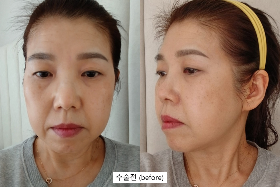 수술만큼 중요한 회복, 결과를 바꾸는 관리의 차이 관련 이미지 1